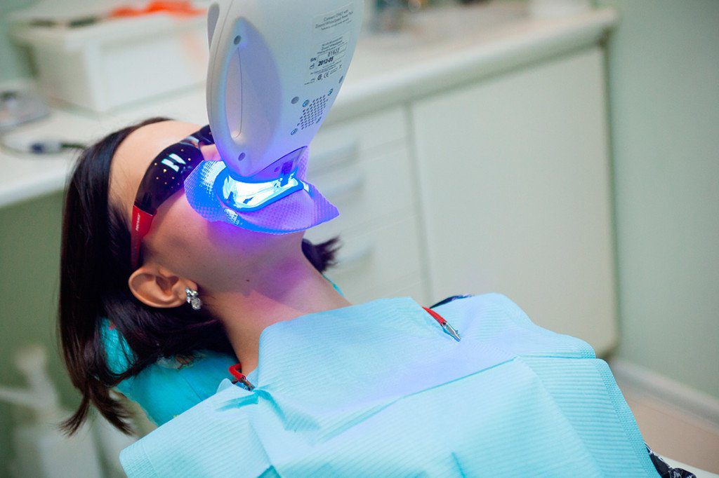How much does teeth whitening cost in the UK? (2026 price guide)