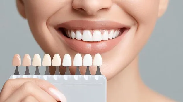 How much do porcelain veneers cost in the UK in 2026?